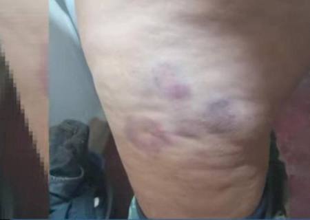 Mulher foge após ser agredida, estuprada e mantida por três dias em cárcere privado em Três Lagoas